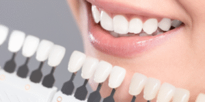 Teeth whitening preparation checklist College Street Dentistry Toronto